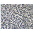 Periodontal disease bacteria